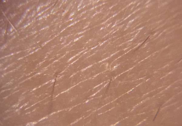 レチノール 系は使い過ぎると危険ですよ 山下小百合の美容論 ラ ジュネス山手倶楽部