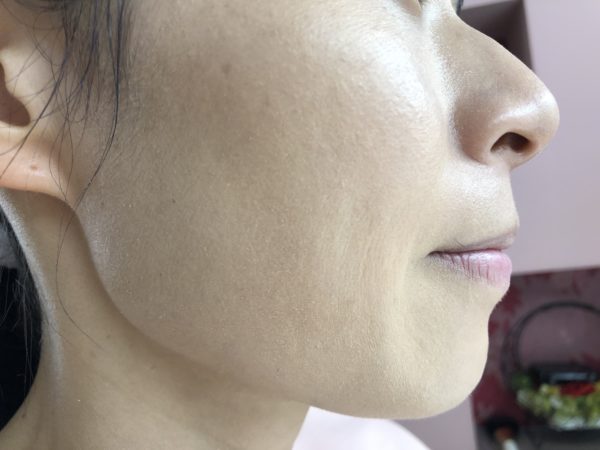 肌がキレイになる方法 | 美肌の達人～ラ・ジュネス山手倶楽部～